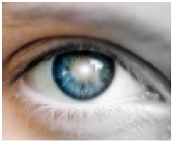 Image of eye