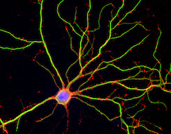 Large mature neuron image