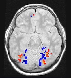 fMRI image
