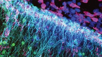 Radial glia (cyan) serving as a roadmap for neurons (green) to find their position in the cortex during development. Nuclei in dark blue and microglia/macrophages in purple.