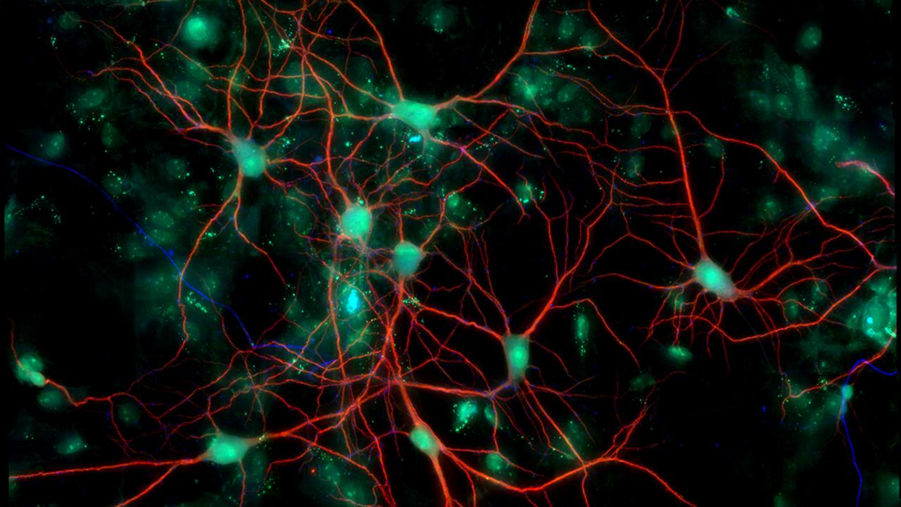 Cell culture of neurons