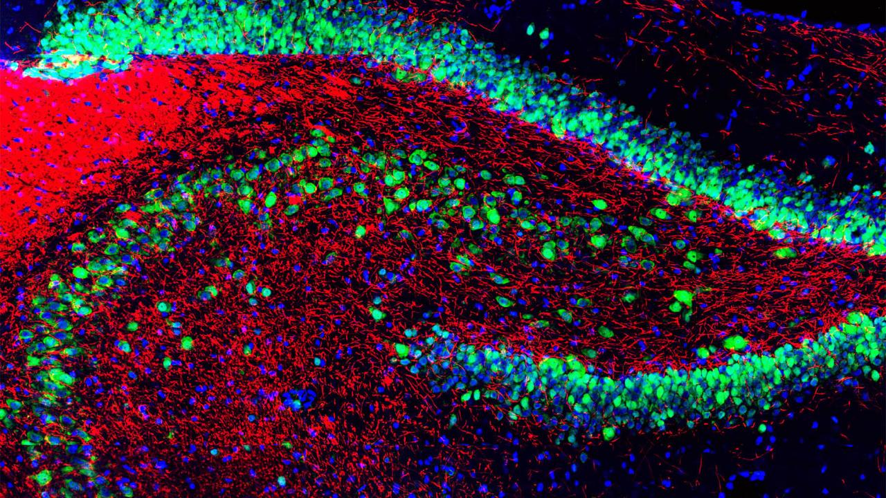 Rat hippocampus stained with antibody for myelin basic protein and DNA