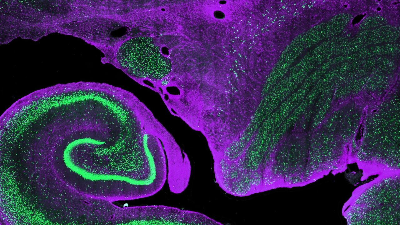 CNS Video