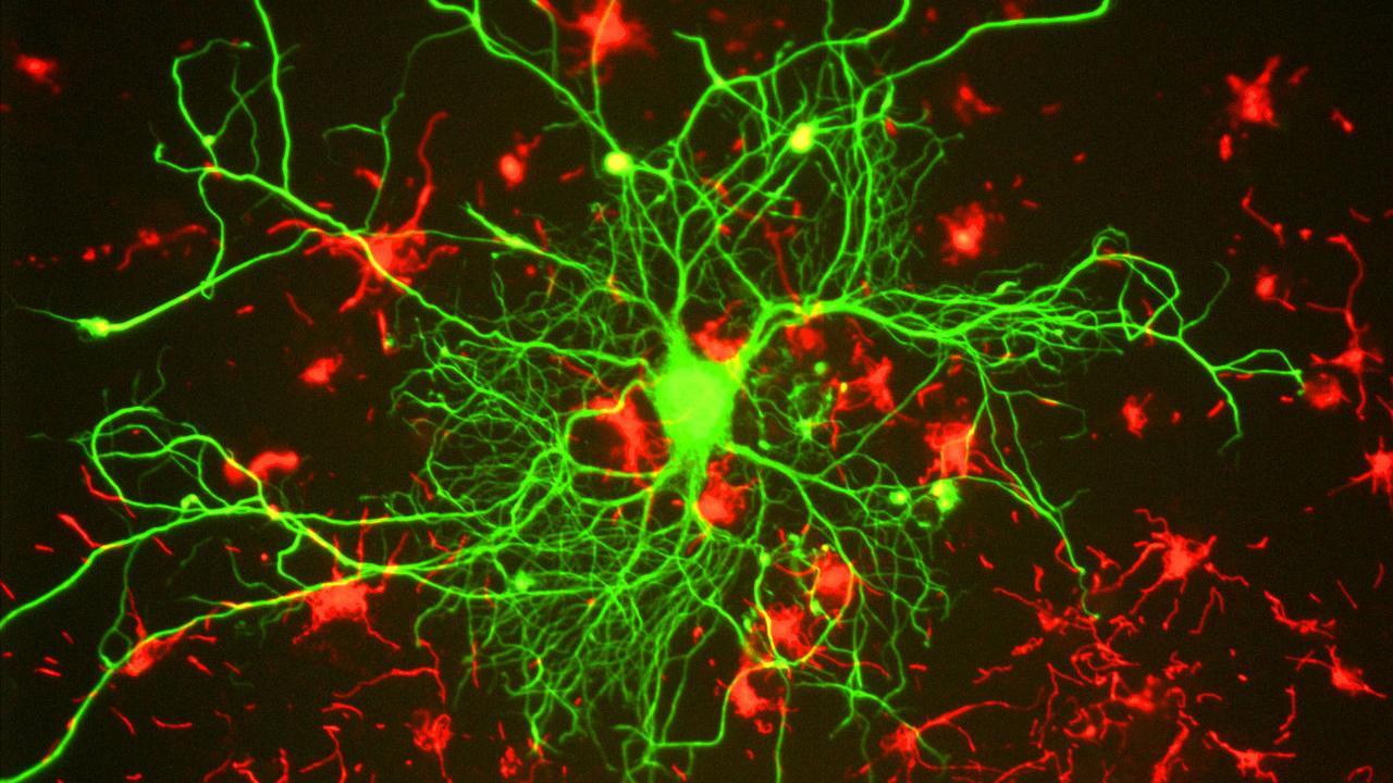 Neuronal Connections