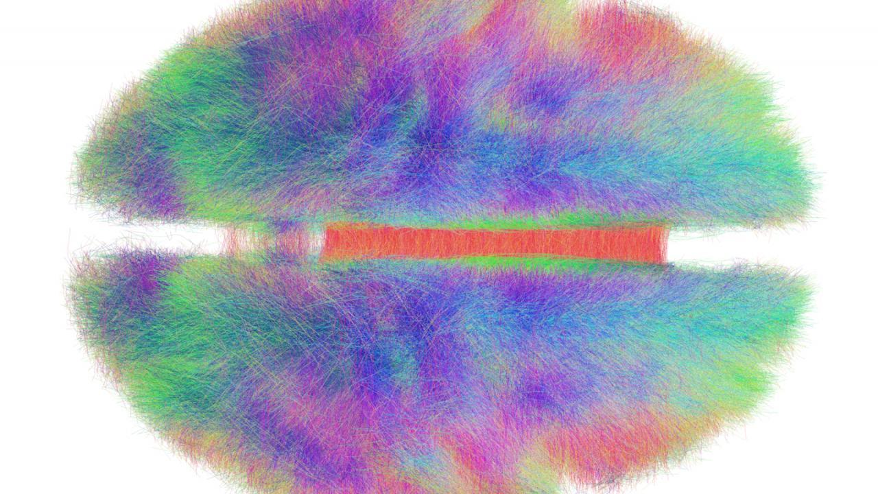 Connectome-computer generated map of the brain