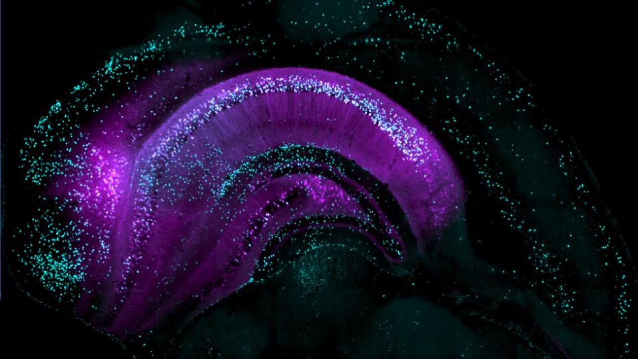 hippocampus