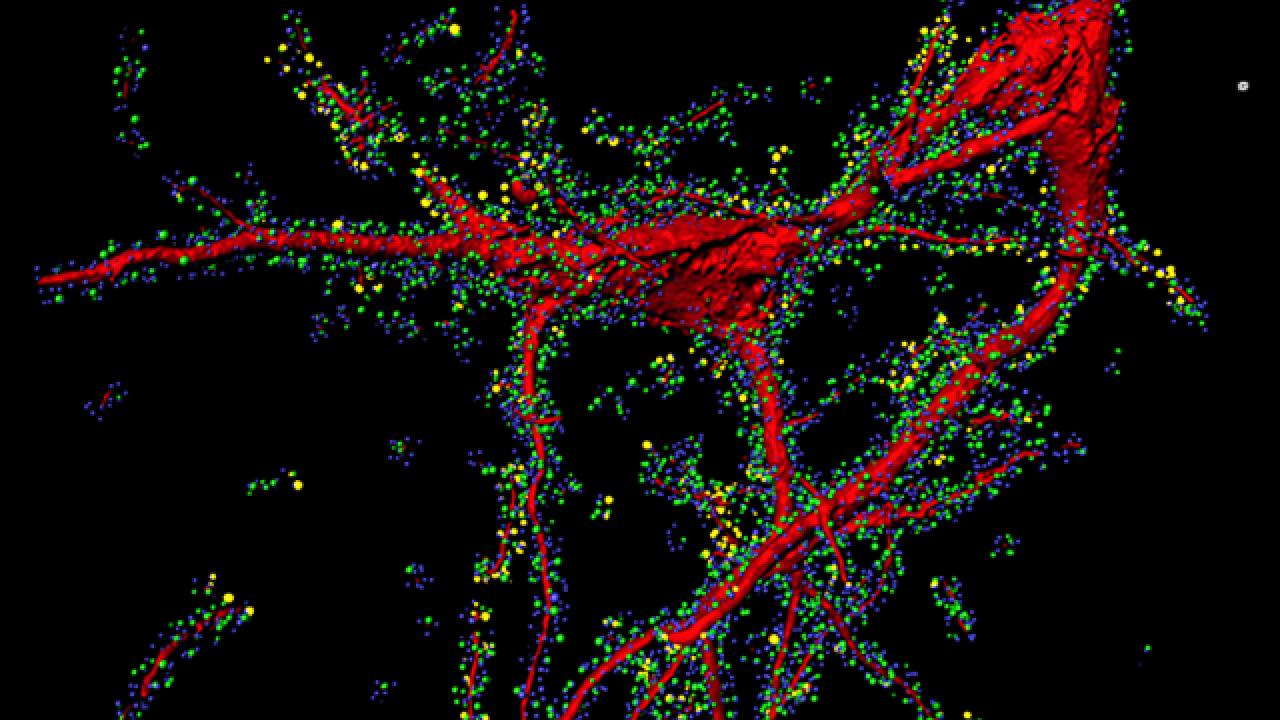 Alzheimer's disease: two main findings is inflammation in the hippocampus and AB oligomers binding to synaptic marker in the prefrontal cortex