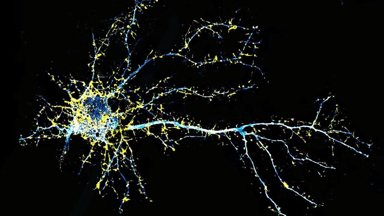 Fluorescent image of a neuron with an intricate network of branching dendrites, shown in glowing blue and yellow against a black background.