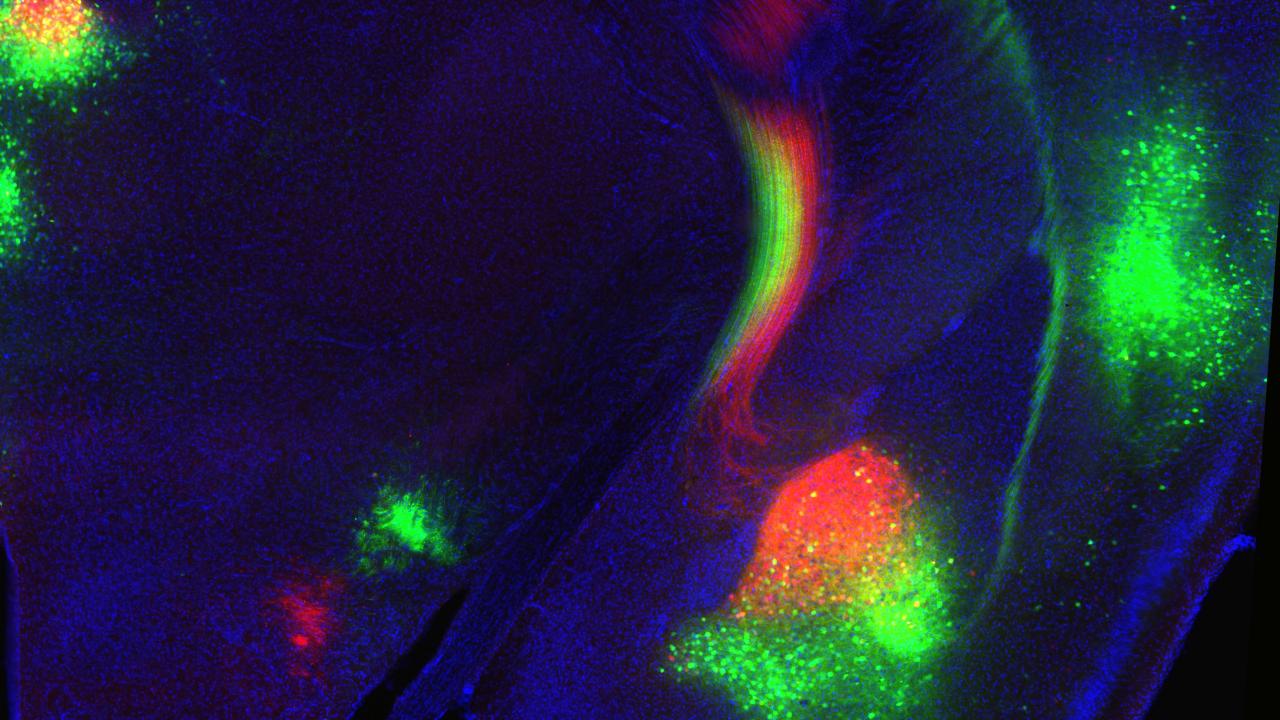 A micrograph image neural projectors to nucleus accumbens medial and lateral shell 