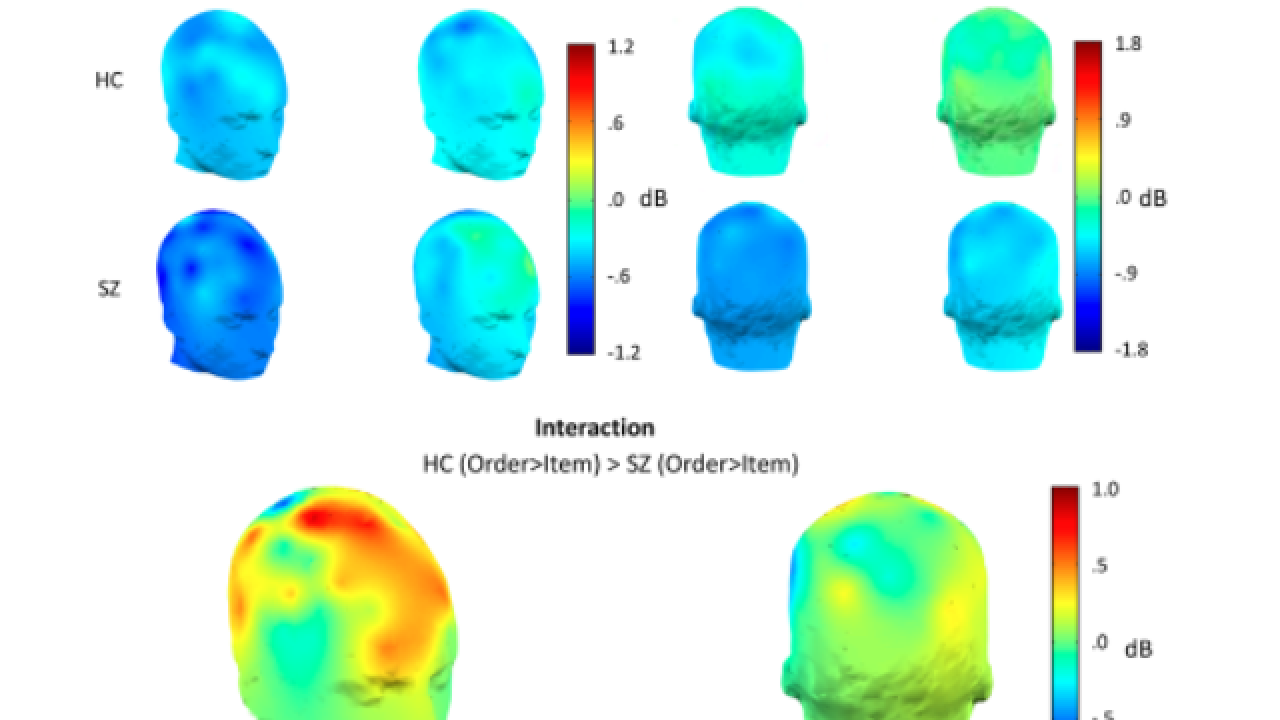 Brightly colored images of the head