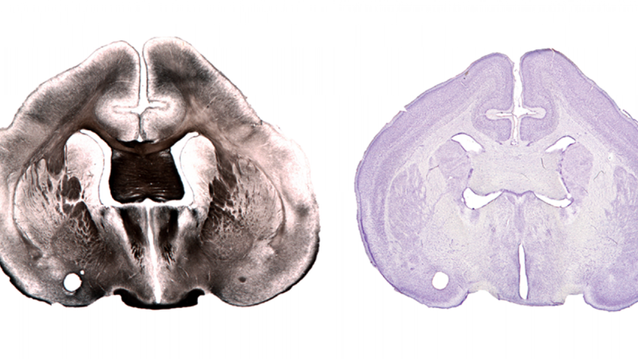 Brain histology and 3D reconstruction