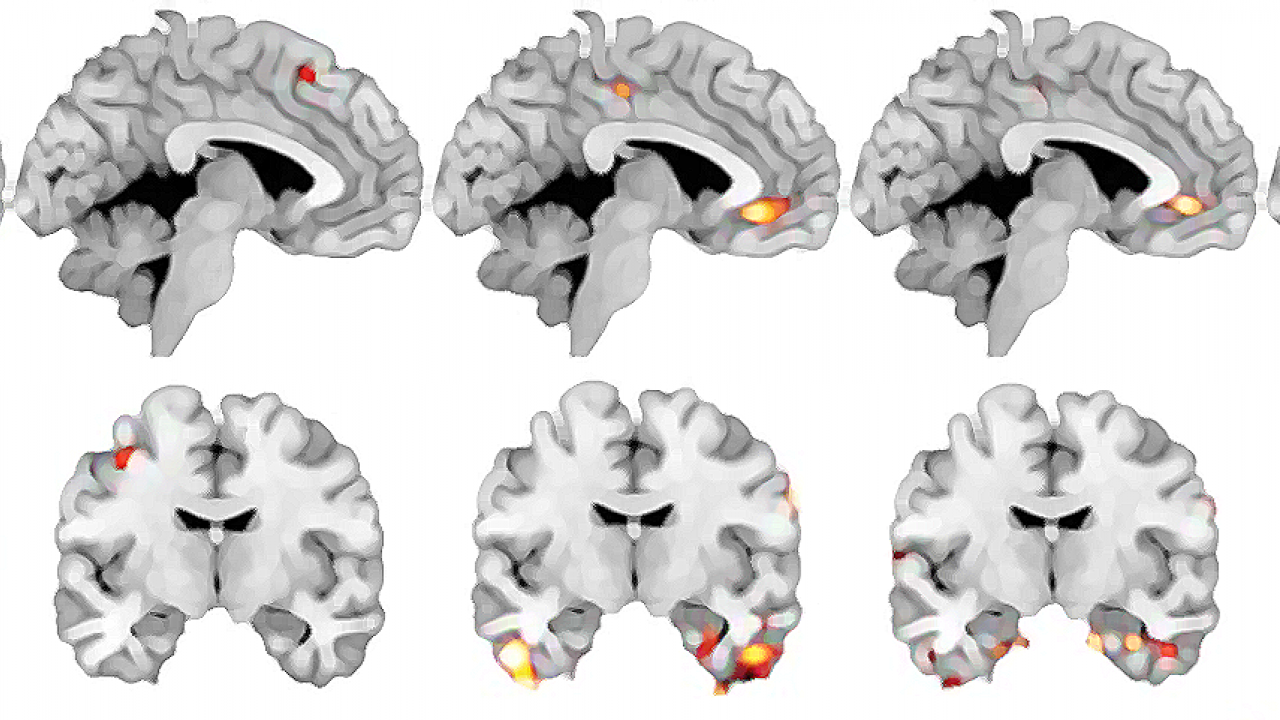 Series of fMRI scans of the brain