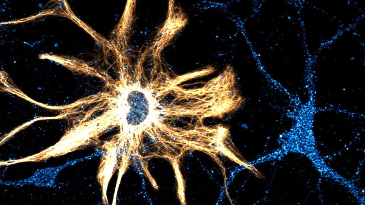 Micrograph image of a neuron