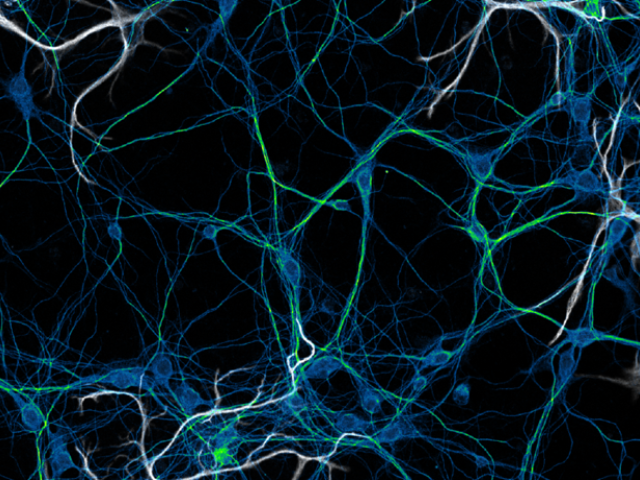 A micrograph image of neuronal networks in vitro