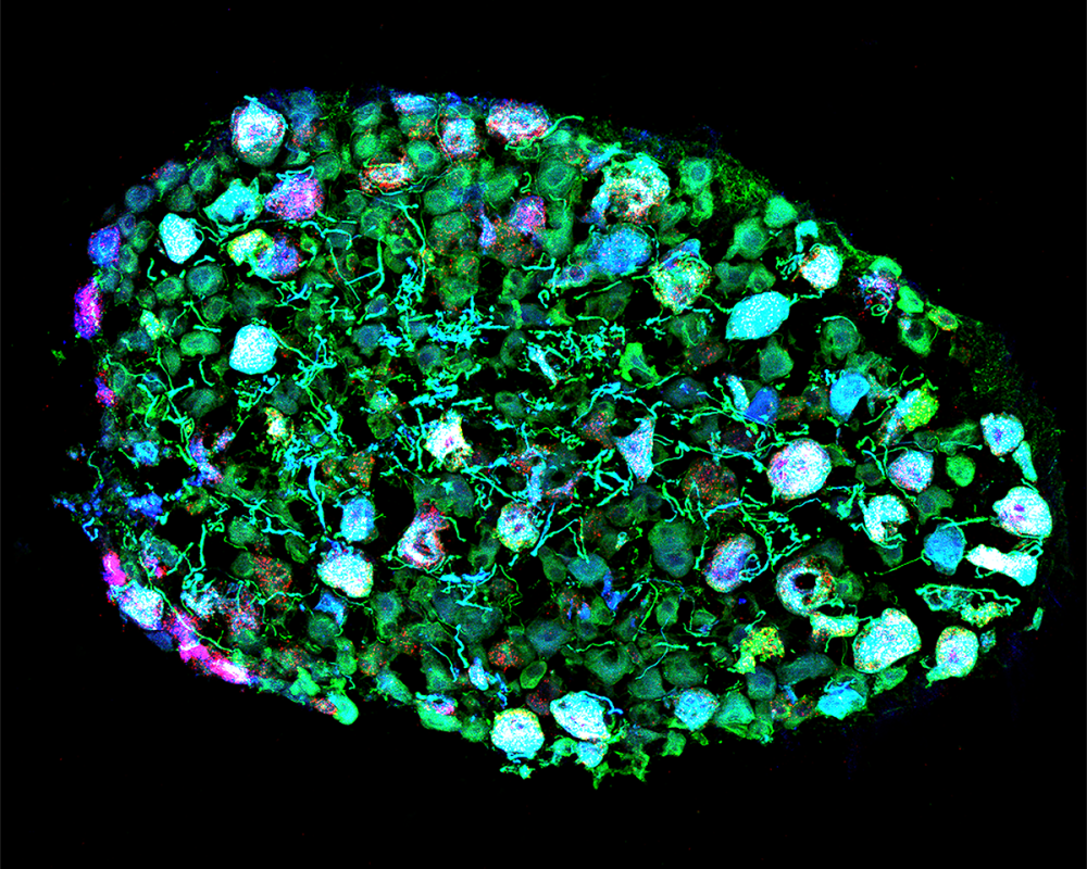 Dorsal Root Ganglia: Hidden Jewels of the Nervous System