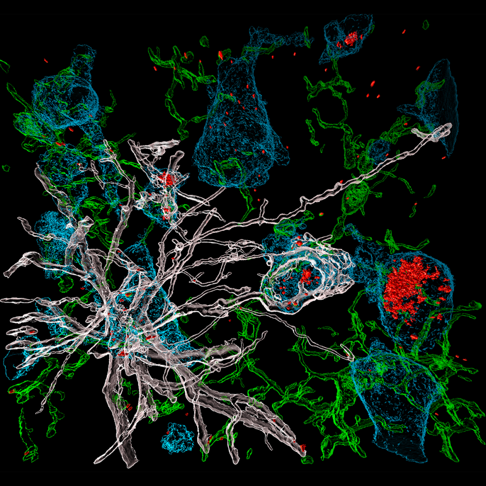 The Last Hope: Glial Cells Attacking SARS-CoV-2 Infected Neurons Danielle Beckman/Morrison Lab NeuroArt Contest 2022 1st Place   