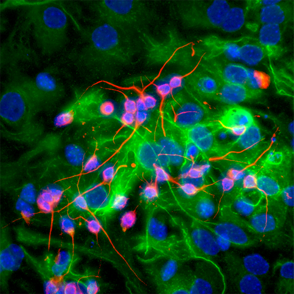 Stem Cells Becoming Brain Cells