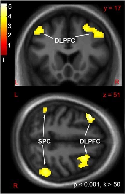 An image of the dorsolateral prefrontal cortex (DLPFC) and superior parietal cortex (SPC)
