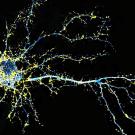 Fluorescent image of a neuron with an intricate network of branching dendrites, shown in glowing blue and yellow against a black background.