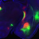 A micrograph image neural projectors to nucleus accumbens medial and lateral shell 