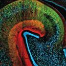 Two different markers for dying neurons (green and red) can be seen accumulating phospho-tau, in contrast to healthy neurons (blue), in a monkey model of Alzheimer's disease.
