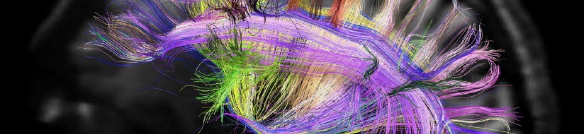 Artistic rendition of mapping the human brain with colored lines