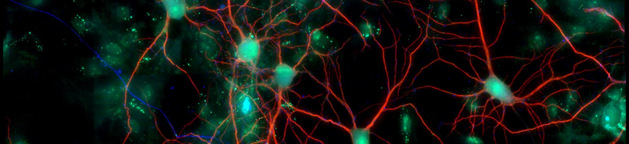 Cell culture of neurons