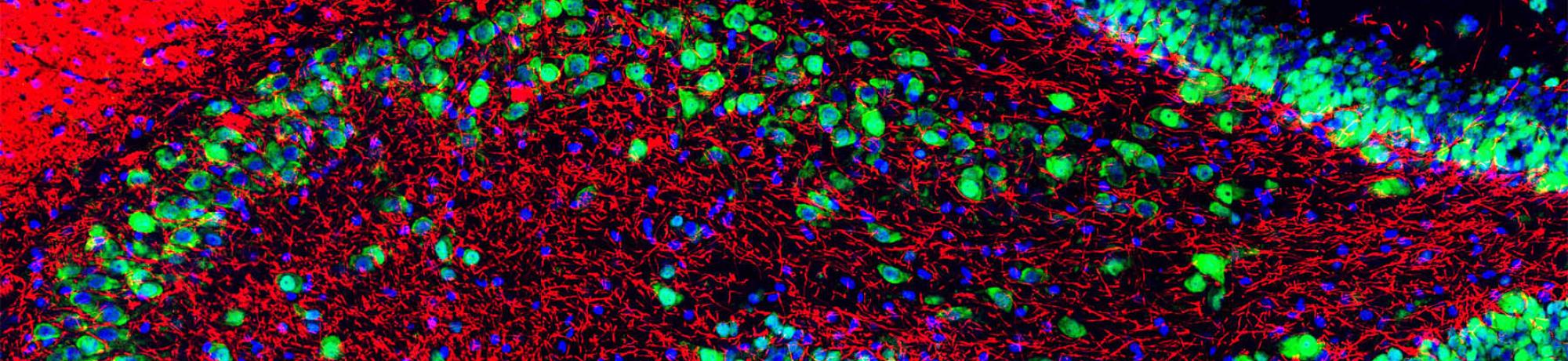 Rat hippocampus stained with antibody for myelin basic protein and DNA