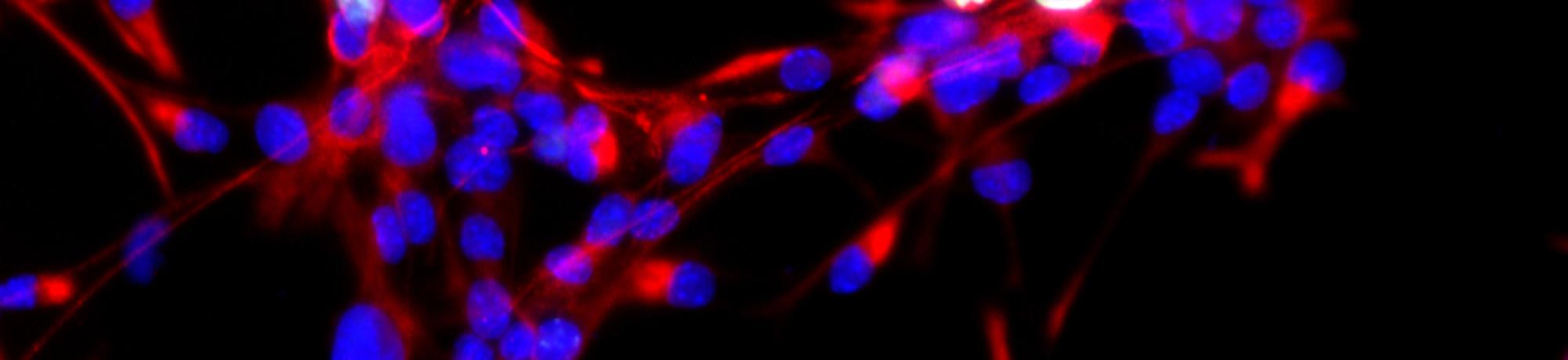 Neural stem cells dividing