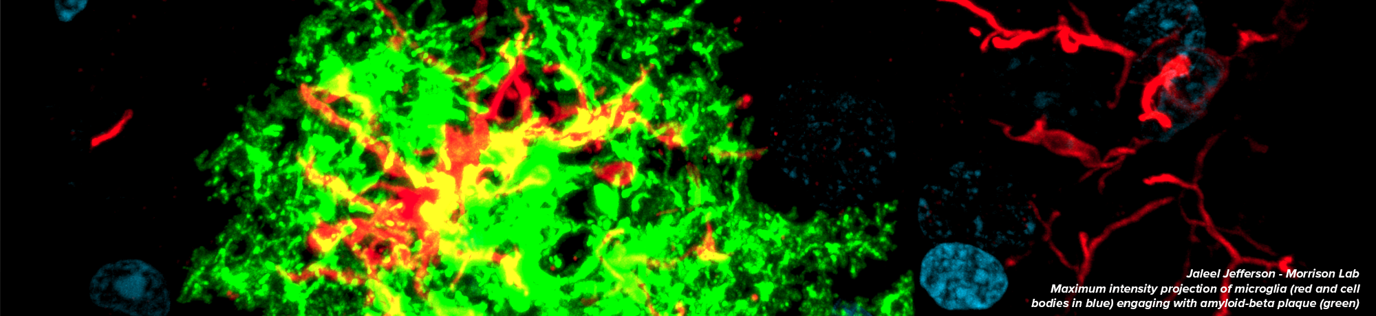Maximum intensity projection of microglia (red and cell bodies in blue) engaging with amyloid-beta plaque (green)