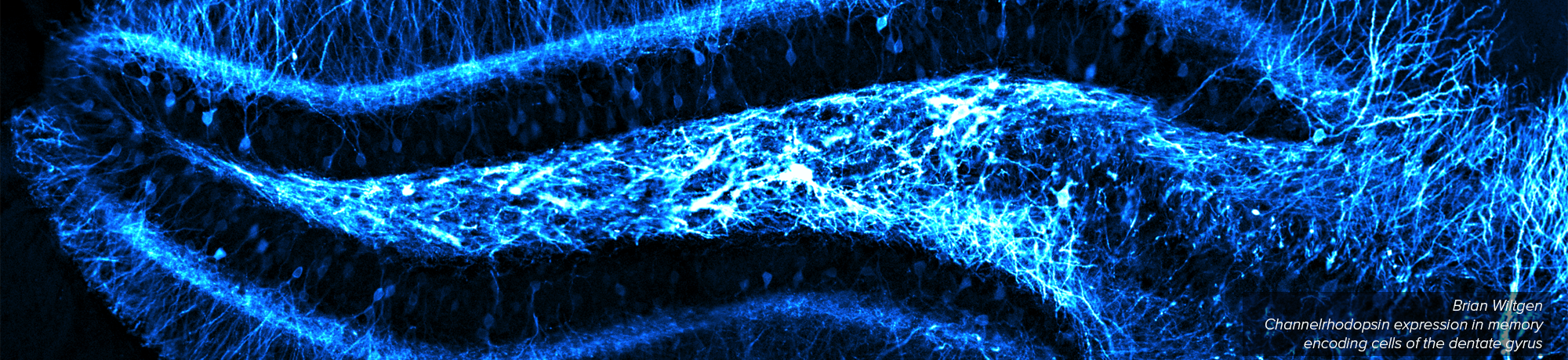 Channelrhodopsin expression in memory encoding cells of the dentate gyrus