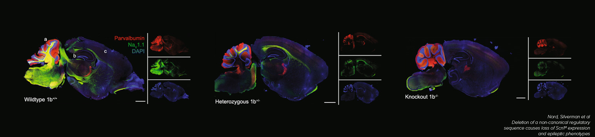 brain imaging
