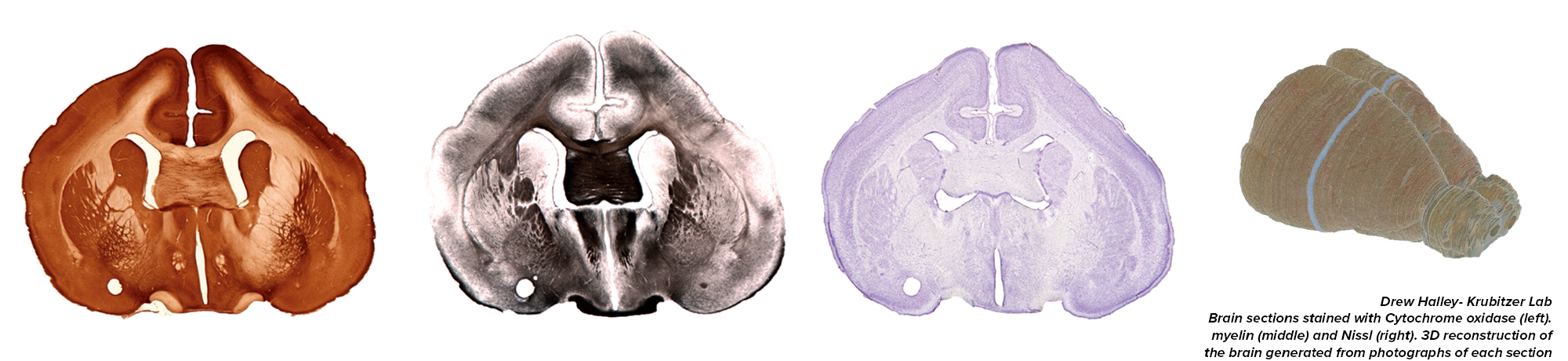 Brain histology and 3D reconstruction