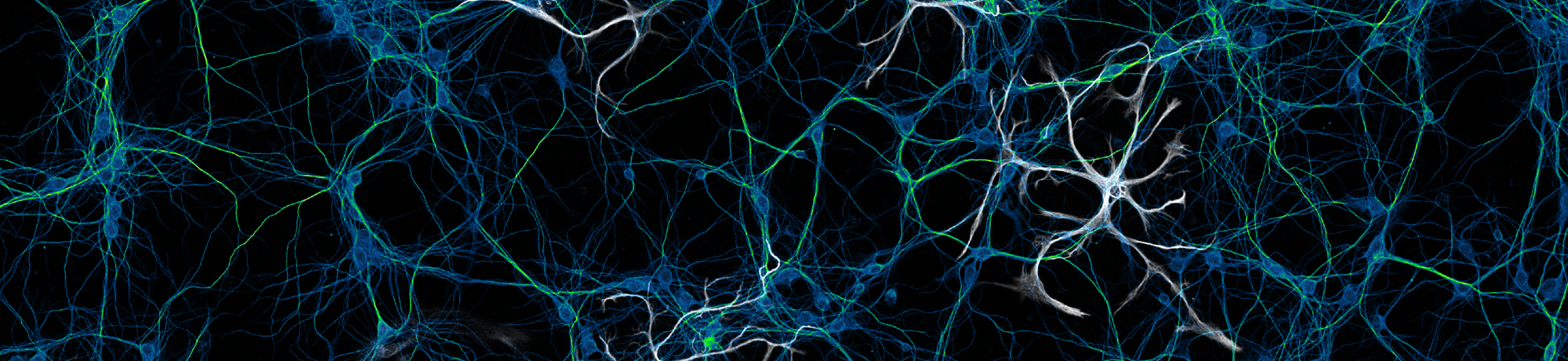 A micrograph image of neuronal networks in vitro