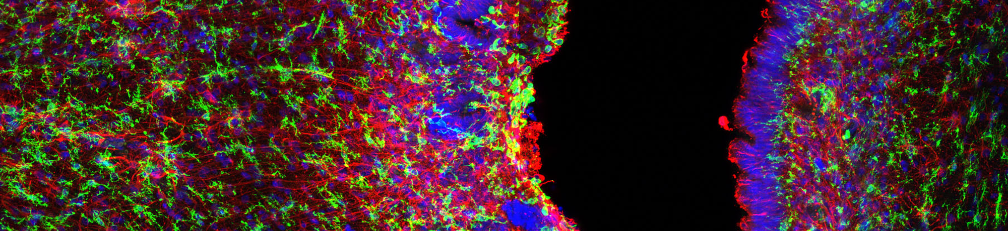 Fluorescently labeled brain section