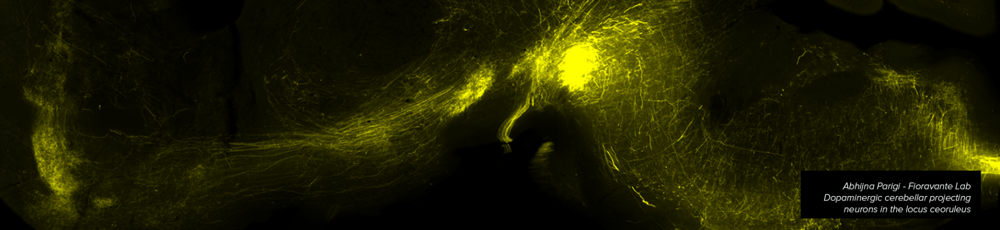 Projections from the cerebellum