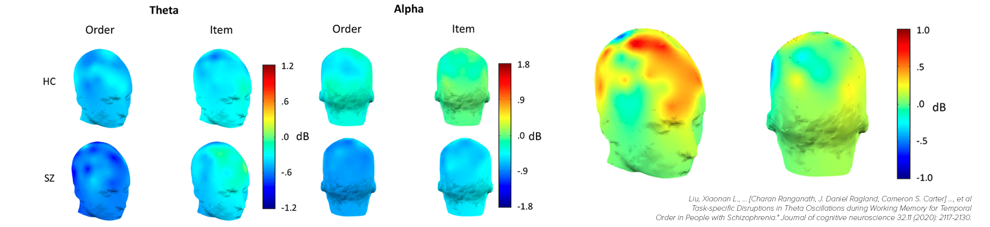 Task-specific Disruptions in Theta Oscillations during Working Memory for Temporal Order in People with Schizophrenia
